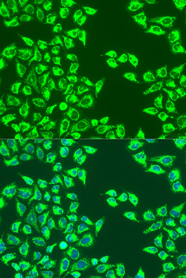 Immunofluorescence analysis of U2OS cells using LRPPRC Polyclonal Antibody at dilution of  1:100. Blue: DAPI for nuclear staining.