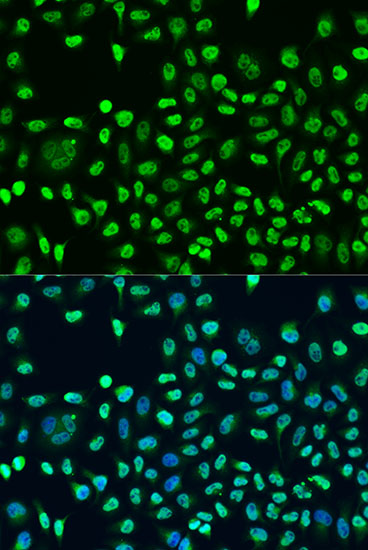 Immunofluorescence analysis of U2OS cells using STAU2 Polyclonal Antibody at dilution of  1:100. Blue: DAPI for nuclear staining.