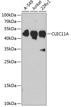 Western blot analysis of extracts of various cell lines using CLEC11A Polyclonal Antibody at dilution of 1:1000.