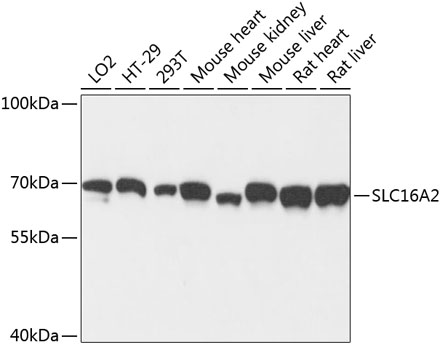 Western blot analysis of extracts of various cell lines using SLC16A2 Polyclonal Antibody at dilution of 1:3000.