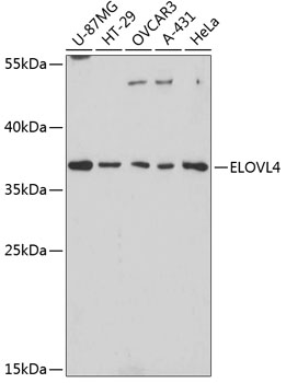 Western blot analysis of extracts of various cell lines using ELOVL4 Polyclonal Antibody at dilution of 1:3000.