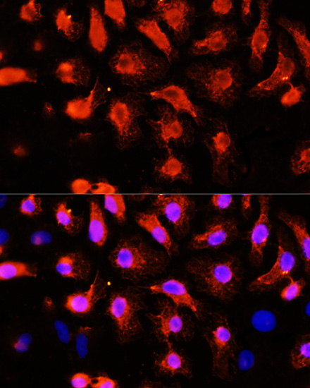 Immunofluorescence analysis of HeLa cells using ACTN2 Polyclonal Antibody at dilution of  1:100 (40x lens). Blue: DAPI for nuclear staining.