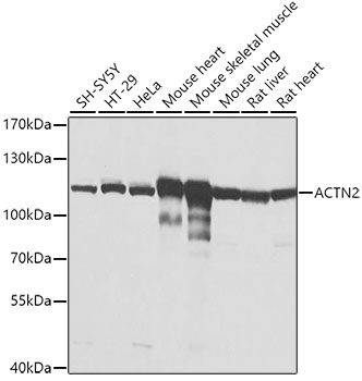 Western blot analysis of extracts of various cell lines using ACTN2 Polyclonal Antibody at dilution of 1:1000.