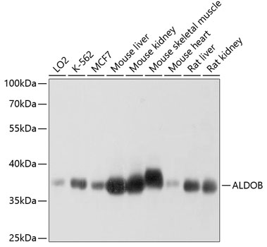 Western blot analysis of extracts of various cell lines using ALDOB Polyclonal Antibody at dilution of 1:1000.