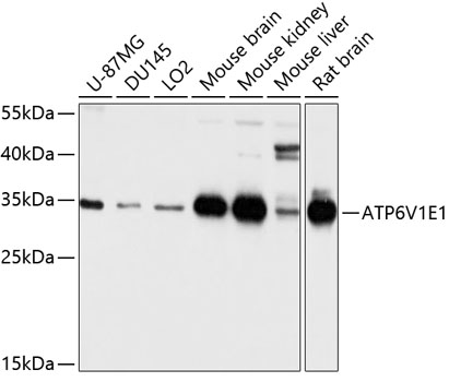 Western blot analysis of extracts of various cell lines using ATP6V1E1 Polyclonal Antibody at dilution of 1:1000.