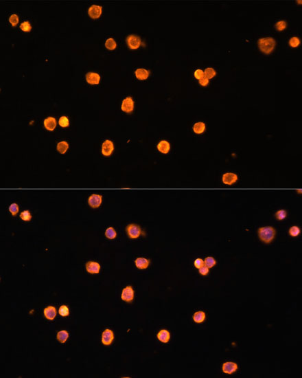 Immunofluorescence analysis of THP-1 cells using ENTPD1/CD39 Polyclonal Antibody at dilution of  1:100 (40x lens). Blue: DAPI for nuclear staining.