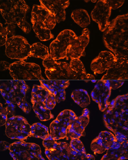 Immunofluorescence analysis of Human placenta using ENTPD1/CD39 Polyclonal Antibody at dilution of  1:100 (40x lens). Blue: DAPI for nuclear staining.