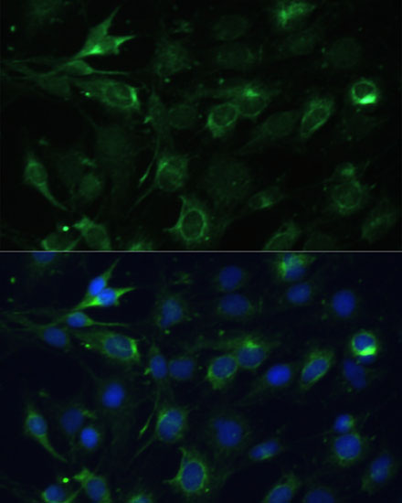 Immunofluorescence analysis of C6 cells using COX6A1 Polyclonal Antibody at dilution of  1:100 (40x lens). Blue: DAPI for nuclear staining.