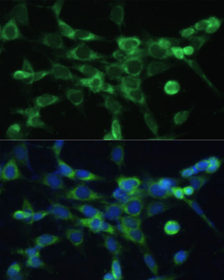 Immunofluorescence analysis of NIH-3T3 cells using COX6A1 Polyclonal Antibody at dilution of  1:100 (40x lens). Blue: DAPI for nuclear staining.