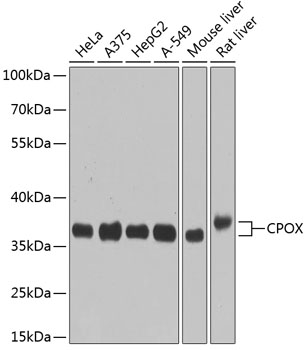 Western blot analysis of extracts of various cell lines using CPOX Polyclonal Antibody at dilution of 1:1000.