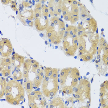 Immunohistochemistry of paraffin-embedded Human stomach using DYNC1I1 Polyclonal Antibody at dilution of  1:100 (40x lens).