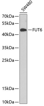 Western blot analysis of extracts of SW480 cells using FUT6 Polyclonal Antibody at dilution of 1:1000.