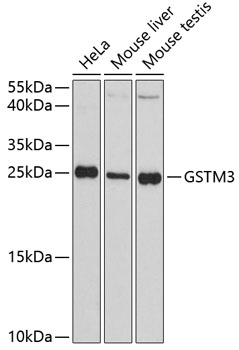 Western blot analysis of extracts of various cell lines using GSTM3 Polyclonal Antibody at dilution of 1:3000.