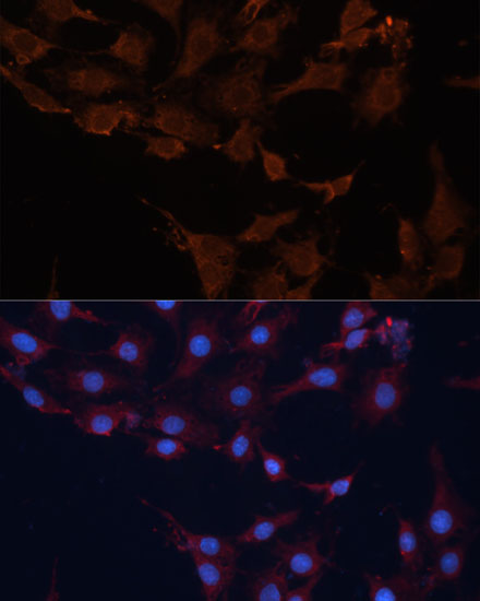 Immunofluorescence analysis of C6 cells using HMGCS1 Polyclonal Antibody at dilution of  1:100 (40x lens). Blue: DAPI for nuclear staining.