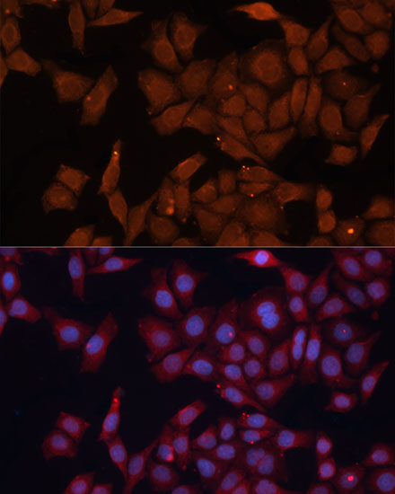 Immunofluorescence analysis of HeLa cells using HMGCS1 Polyclonal Antibody at dilution of  1:100 (40x lens). Blue: DAPI for nuclear staining.