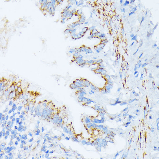Immunohistochemistry of paraffin-embedded Rat lung using IL3RA Polyclonal Antibody at dilution of  1:100 (40x lens).