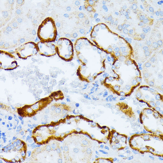 Immunohistochemistry of paraffin-embedded Mouse kidney using IL3RA Polyclonal Antibody at dilution of  1:100 (40x lens).
