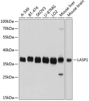 Western blot analysis of extracts of various cell lines using LASP1 Polyclonal Antibody at dilution of 1:1000.