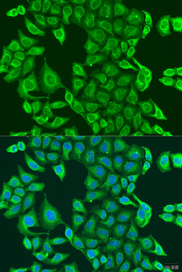 Immunofluorescence analysis of U2OS cells using PDK2 Polyclonal Antibody at dilution of  1:100. Blue: DAPI for nuclear staining.