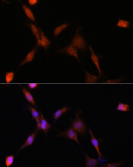 Immunofluorescence analysis of NIH-3T3 cells using PSMA7 Polyclonal Antibody at dilution of  1:100. Blue: DAPI for nuclear staining.