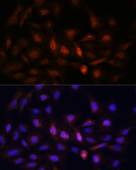 Immunofluorescence analysis of U-2 OS cells using PSMA7 Polyclonal Antibody at dilution of  1:100. Blue: DAPI for nuclear staining.