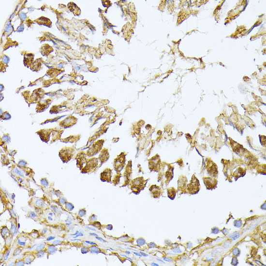 Immunohistochemistry of paraffin-embedded Rat testis using PSMA7 Polyclonal Antibody at dilution of  1:100 (40x lens).