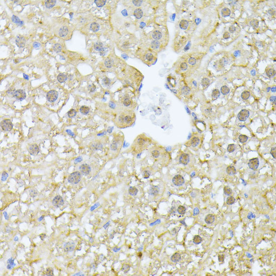 Immunohistochemistry of paraffin-embedded Mouse liver using PSMA7 Polyclonal Antibody at dilution of  1:100 (40x lens).