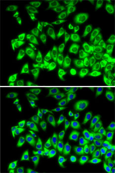 Immunofluorescence analysis of MCF7 cells using RPL13 Polyclonal Antibody