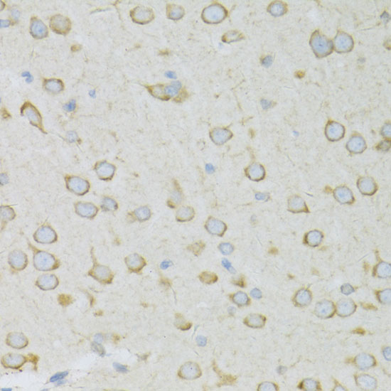 Immunohistochemistry of paraffin-embedded Rat brain using RPL13 Polyclonal Antibody at dilution of  1:100 (40x lens).