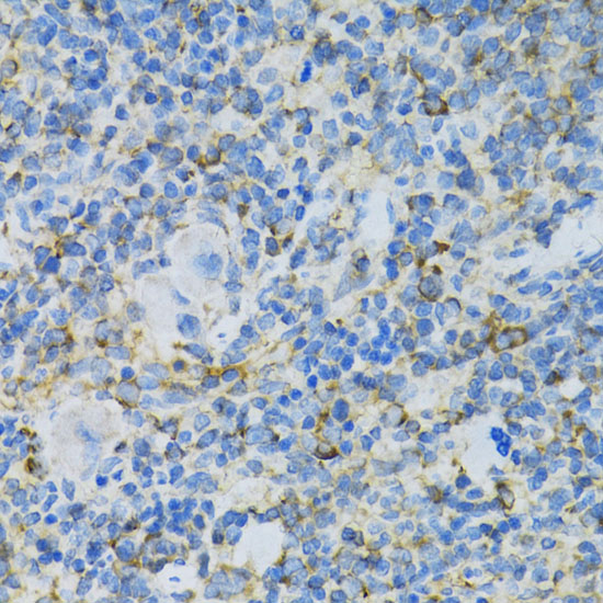 Immunohistochemistry of paraffin-embedded Rat spleen using RPL13 Polyclonal Antibody at dilution of  1:100 (40x lens).