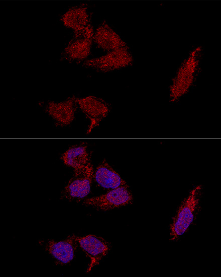 Confocal immunofluorescence analysis of HeLa cells using RPL23A Polyclonal Antibody at dilution of  1:100. Blue: DAPI for nuclear staining.