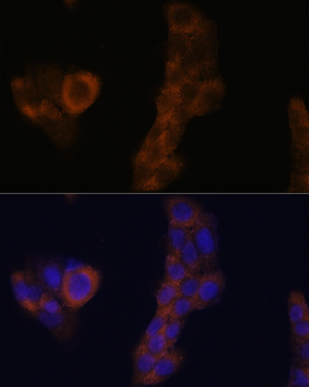 Immunofluorescence analysis of A-431 cells using RPL23A Polyclonal Antibody at dilution of  1:100. Blue: DAPI for nuclear staining.