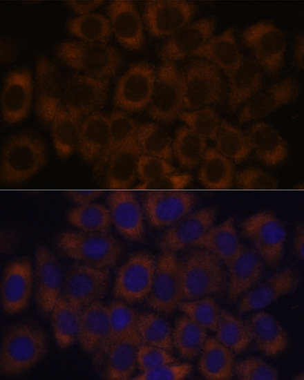 Immunofluorescence analysis of HeLa cells using RPL23A Polyclonal Antibody at dilution of  1:100. Blue: DAPI for nuclear staining.