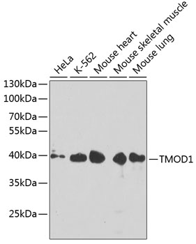 Western blot analysis of extracts of various cell lines using TMOD1 Polyclonal Antibody at dilution of 1:1000.