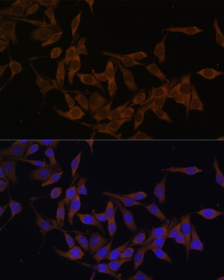 Immunofluorescence analysis of HeLa cells using UBE2L3 Polyclonal Antibody at dilution of  1:100 (40x lens). Blue: DAPI for nuclear staining.