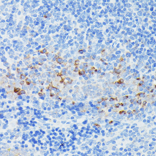 Immunohistochemistry of paraffin-embedded Mouse spleen using IFITM1 Polyclonal Antibody at dilution of  1:100 (40x lens).