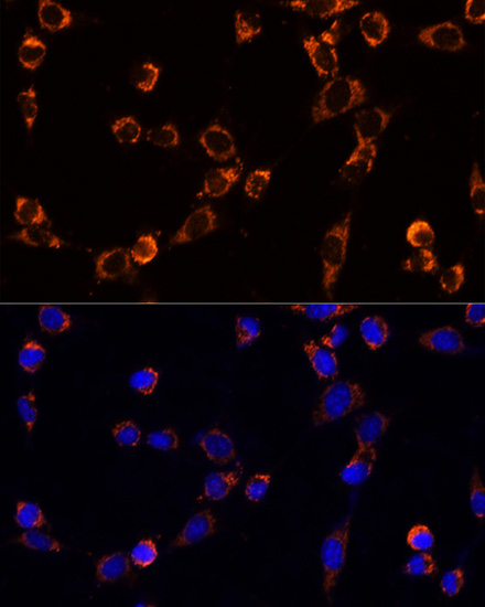 Immunofluorescence analysis of NIH/3T3 cells using TRAP1 Polyclonal Antibody at dilution of  1:100. Blue: DAPI for nuclear staining.