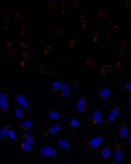 Immunofluorescence analysis of U2OS cells using TRAP1 Polyclonal Antibody at dilution of  1:100. Blue: DAPI for nuclear staining.