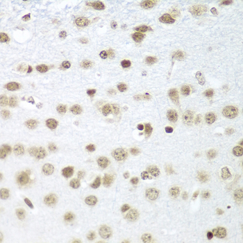 Immunohistochemistry of paraffin-embedded Mouse brain using SAP18 Polyclonal Antibody at dilution of  1:100 (40x lens).