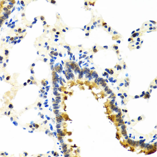 Immunohistochemistry of paraffin-embedded Rat lung using CRTAP Polyclonal Antibody at dilution of  1:100 (40x lens).