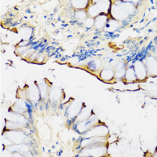 Immunohistochemistry of paraffin-embedded Human colon using CRTAP Polyclonal Antibody at dilution of  1:100 (40x lens).