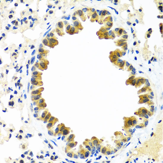 Immunohistochemistry of paraffin-embedded Mouse lung using CRTAP Polyclonal Antibody at dilution of  1:100 (40x lens).