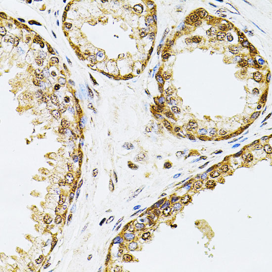 Immunohistochemistry of paraffin-embedded Human prostate using POP4 Polyclonal Antibody at dilution of  1:100 (40x lens).