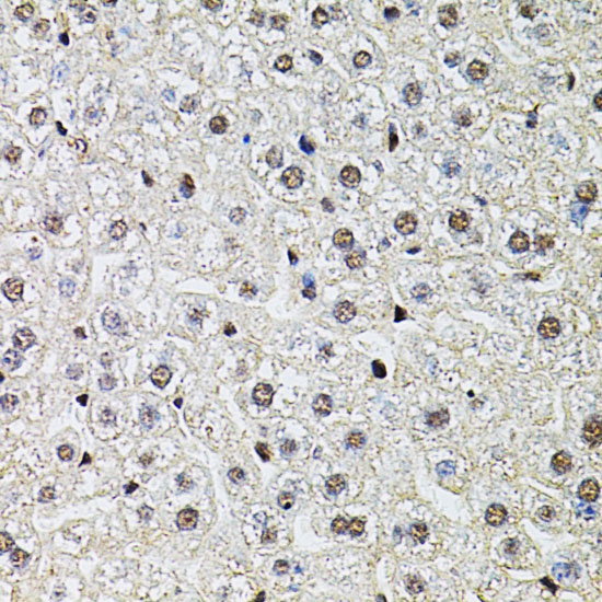 Immunohistochemistry of paraffin-embedded Mouse liver using POP4 Polyclonal Antibody at dilution of  1:100 (40x lens).