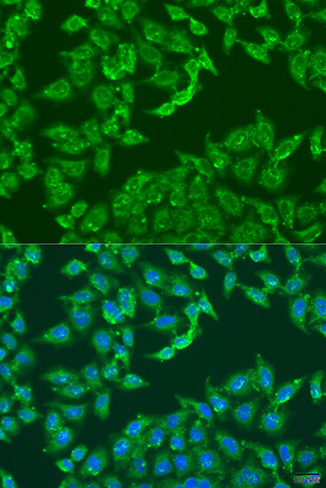 Immunofluorescence analysis of U2OS cells using ADAP1 Polyclonal Antibody at dilution of  1:100. Blue: DAPI for nuclear staining.