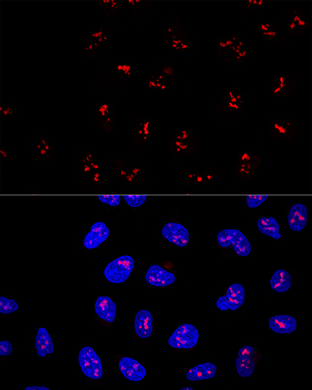 Confocal immunofluorescence analysis of U2OS cells using KRR1 Polyclonal Antibody at dilution of  1:100. Blue: DAPI for nuclear staining.