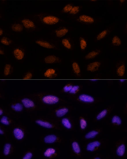 Immunofluorescence analysis of U-2 OS cells using ADNP Polyclonal Antibody at dilution of  1:100 (40x lens). Blue: DAPI for nuclear staining.