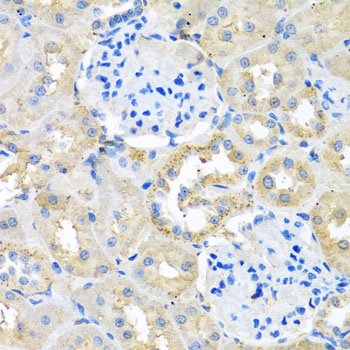 Immunohistochemistry of paraffin-embedded Rat kidney using COTL1 Polyclonal Antibody at dilution of  1:100 (40x lens).