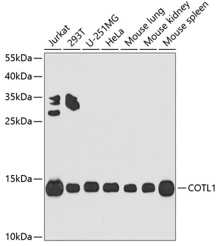 Western blot analysis of extracts of various cell lines using COTL1 Polyclonal Antibody at dilution of 1:1000.