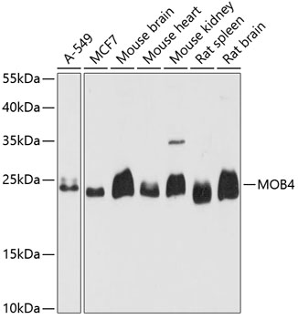 Western blot analysis of extracts of various cell lines using MOB4 Polyclonal Antibody at dilution of 1:3000.